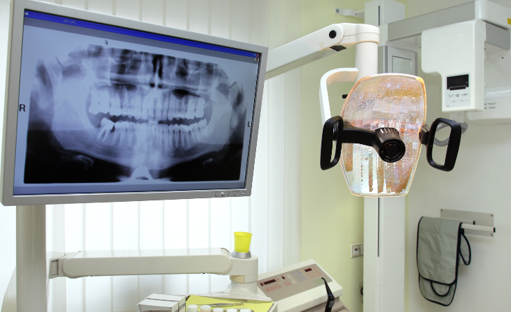 Rehberli implant cerrahisi